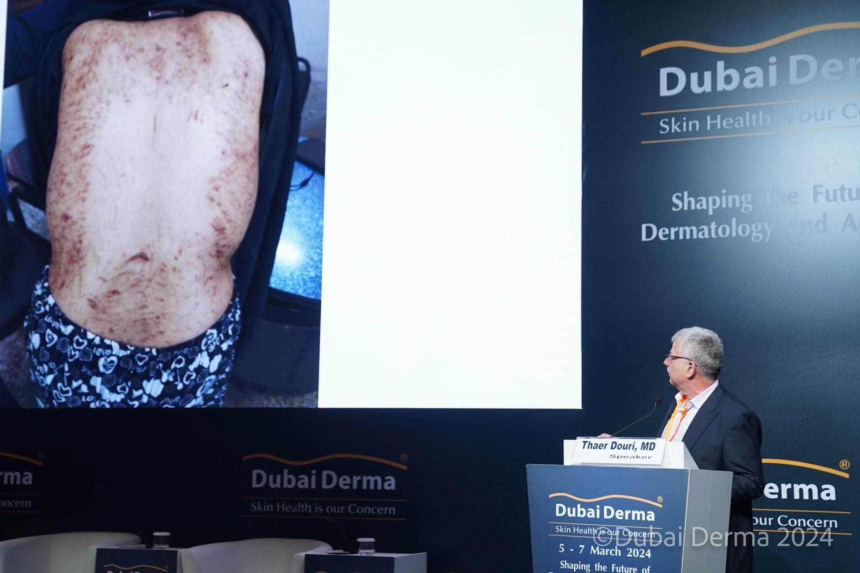 두바이 더마 국제 피부미용 및 레이저 컨퍼런스 전시회 2026 (Dubai Derma)